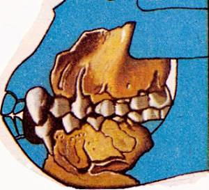 ископаемые зубы рамапитека фрагмент челюсти
